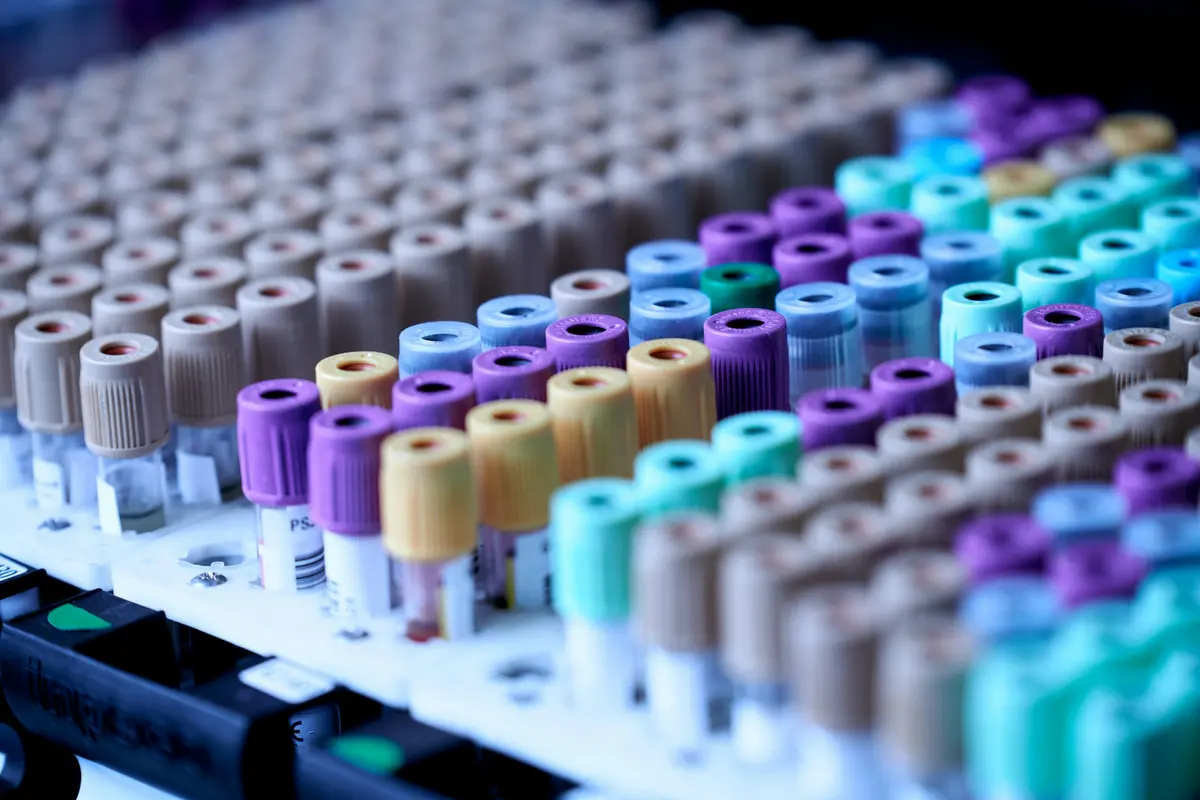 Sample tubes in a lab's rack